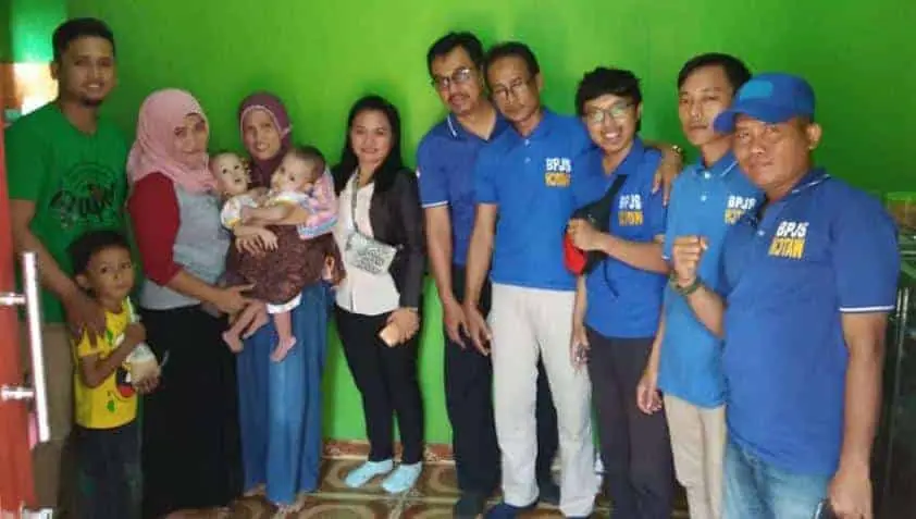 BPJS WATCH Pertanyakan Kitabisa.com Terkait Penggalangan Dana Operasi Bayi Kembar Siam