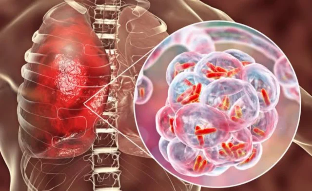 Kasus Pneumonia Merebak di Cina, Masyarakat Diimbau Terapkan PHBS