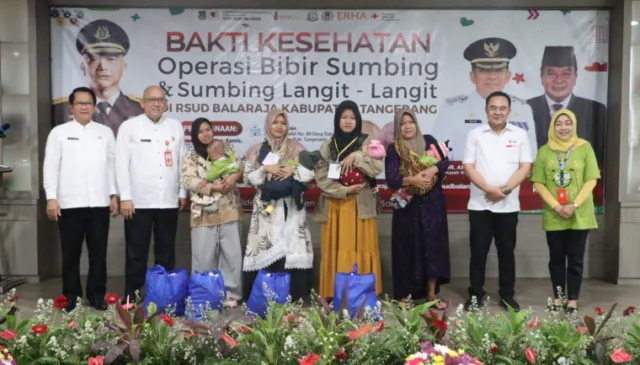 Bakti Kesehatan Gratis, RSUD Balaraja Gelar Operasi Bibir Sumbing